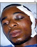 John Dehwa, a member of Zimbabwe's opposition MDC party, lies in hospital after he was allegedly beaten by militant Mugabe supporters