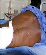 Man with MDC carved into his back