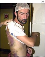 Injured protester