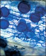 Mycorrhizae in plant roots Science