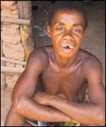 Pygmies file their teeth to help them eat meat 