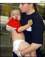 Injured Israeli infant