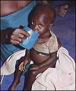 Child refugee suffering from Aids in Uganda 