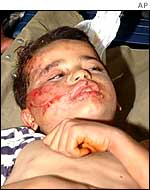 Wounded Palestinian boy