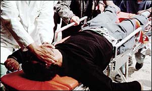 Suicide bombing victim