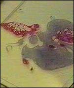 post-mortem tissue from beached whale