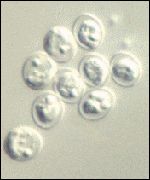 Cryptosporidium 