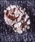 Varroa mite, Horticulture Research International Association 