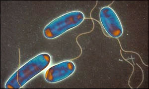 Legionella bacteria: courtesy of Science Photo Library