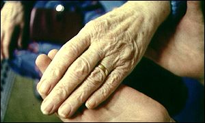 Rheumatoid arthritis affects thousands