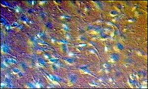 Sperm under microscope