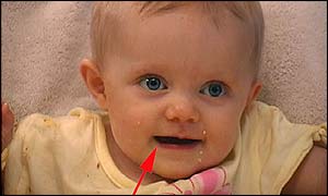 Baby - arrow pointing to right side of mouth indicating language