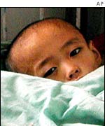 A 14-year-old North Korean boy suffering from malnutrition in South Hamgyong province, North Korea