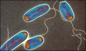 Legionella bacteria: courtesy of Science Photo Library