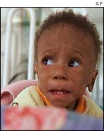 Wiseman, aged 13 months, in hospital in Soweto, Johannesburg
