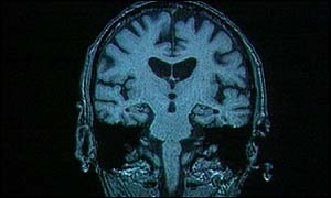 Brain scan