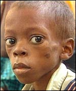 Angolan child