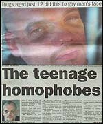 The attack was reported in Brighton local paper, the Argus