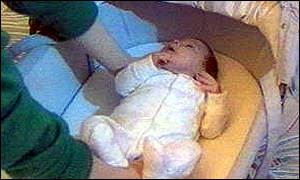 Placing babies on their backs reduces cot death risk