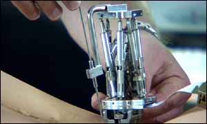 Robot being used in surgery