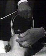 Patient being electrocuted years ago