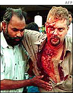 Man helped from Sheraton bomb attack