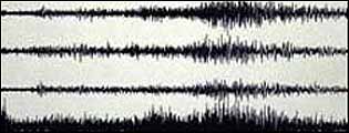 A seismograph