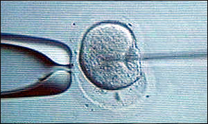 IVF fertilisation