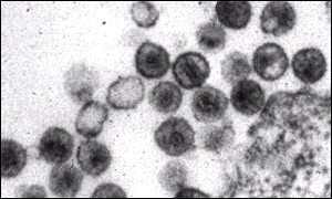 Some patients can block the development of HIV