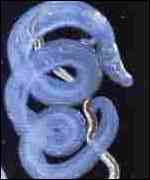 The eggs of parasitic worms cause bilharzias