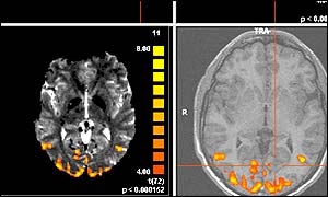 Brain scans showing activity when people see (copyright University of Leicester)