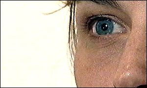 The condition is the leading cause of blindness