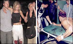 Survivors at the scene (L) Photo: AFP; Injured on stretcher (R) Photo: AP