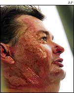 Bali bomb victim Laurie Kerr