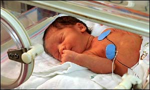 Premature baby