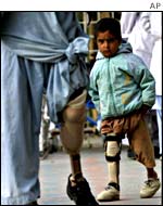 An Afghan child with a prosthetic leg from an orthopaedic hospital