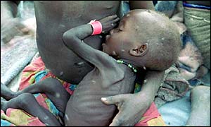 Under-nourished child