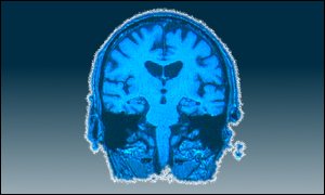 Brain scan