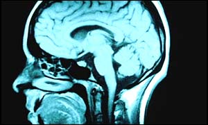 Brain scan (Corbis)