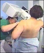 Mammogram