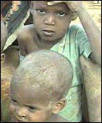 Ethiopian famine victims
