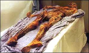 Oetzi the Iceman