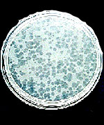 Petri dish, showing gaps caused by TB-attacking viruses