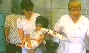 Child in Argentine suffering from malnutrition