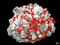 HIV infecting a T-cell