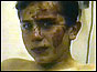 Injured young boy