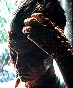 make-up showing smallpox