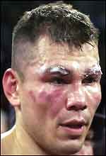 Raul Marquez, whose cuts caused the end of his fight with Shane Mosley