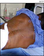 MDC activist in hospital