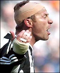 Newcastle's Alan Shearer with his head bandaged
